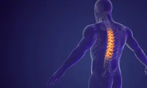 Anatomical illustration of a human spine with highlighted areas indicating dyskopatia wielopoziomowa.