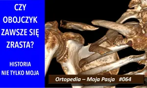 Trójwymiarowy obraz obojczyka i łopatki, z tekstem "CZY OBOJCZYK ZAWSZE SIĘ ZRASTA?".