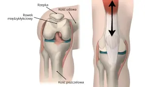 Ilustracja anatomiczna kolana z zaznaczoną rzepką, kością udową i piszczelową.