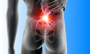 Anatomia miednicy z bólem w dolnej części pleców i promieniującym bólem.