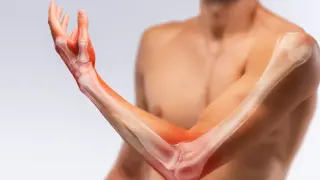Anatomia ręki i przedramienia z widocznymi kośćmi i podświetlonymi obszarami.