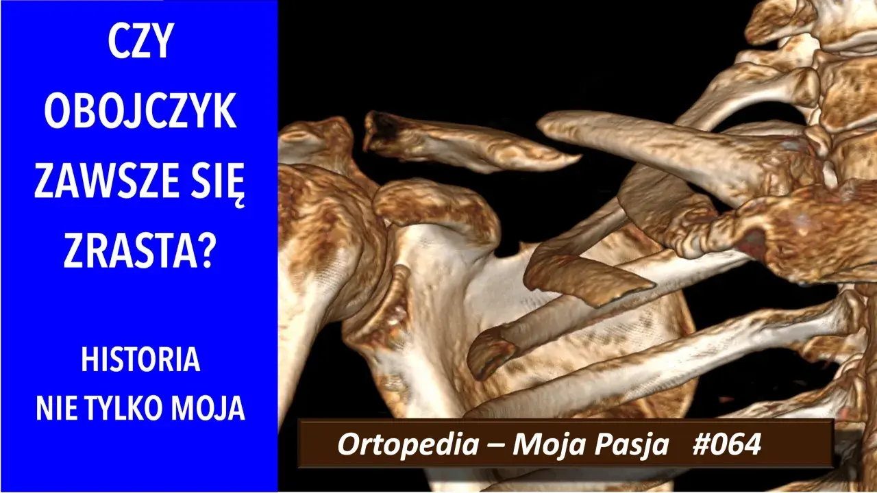 Trójwymiarowy obraz obojczyka i łopatki, z tekstem "CZY OBOJCZYK ZAWSZE SIĘ ZRASTA?".