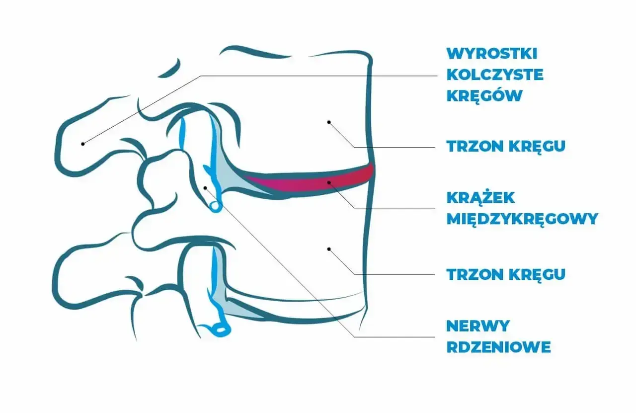 Schemat kręgosłupa z zaznaczonym krążkiem międzykręgowym, trzonami kręgów i nerwami rdzeniowymi.