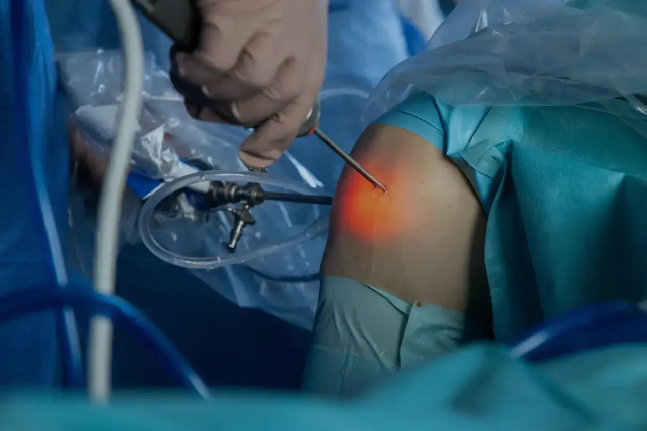 Chirurg używa narzędzia z podświetleniem, które emituje laser wysokoenergetyczny, podczas zabiegu artroskopowego.