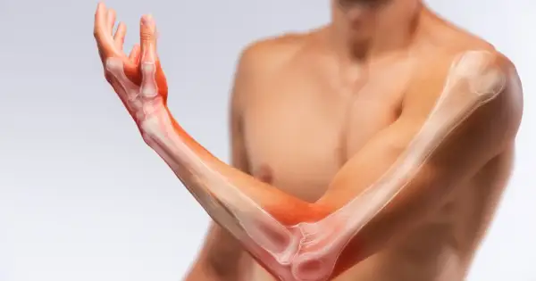 Anatomia ręki i przedramienia z widocznymi kośćmi i podświetlonymi obszarami.