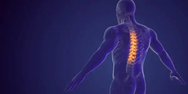 Anatomical illustration of a human spine with highlighted areas indicating dyskopatia wielopoziomowa.