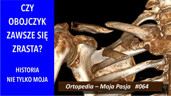 Trójwymiarowy obraz obojczyka i łopatki, z tekstem "CZY OBOJCZYK ZAWSZE SIĘ ZRASTA?".
