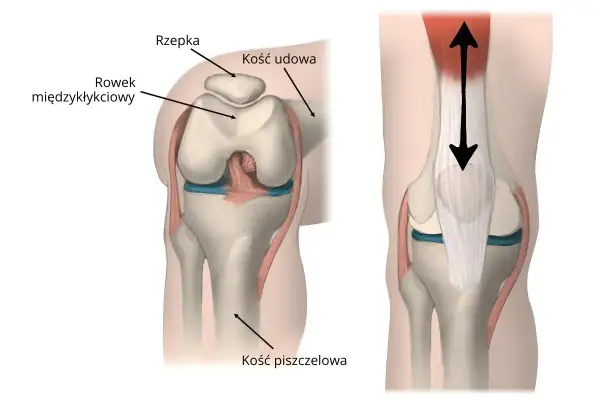 Ilustracja anatomiczna kolana z zaznaczoną rzepką, kością udową i piszczelową.