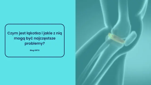 Ilustracja anatomiczna stawu kolanowego z widoczną łąkotką.