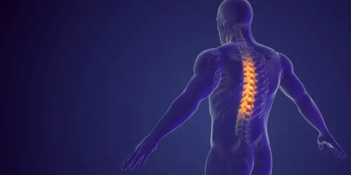 Anatomical illustration of a human spine with highlighted areas indicating dyskopatia wielopoziomowa.